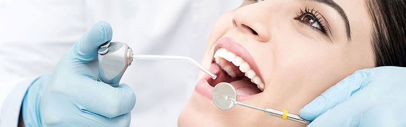 Igiene Orale e Prevenzione