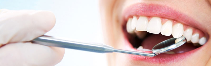 Patologie della cavità orale